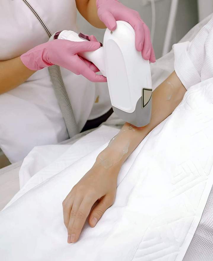 Épilation par laser Sherbrooke