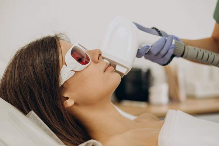 Épilation au laser du visage Sherbrooke