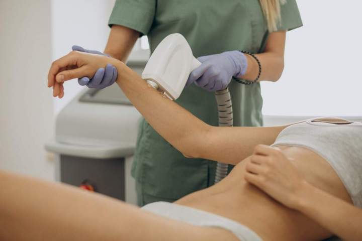 Épilation au laser du bras Sherbrooke