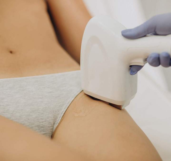 Épilation douce et confortable du bikini