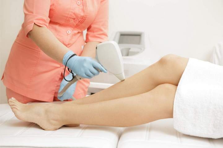 Épilation des jambes par laser Sherbrooke
