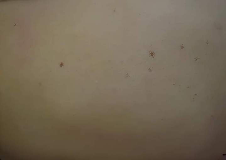 Hyperpigmentation durée 1 à 3 jours