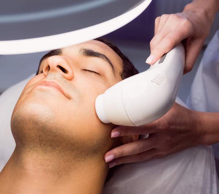 Un visage lisse et lumineux grâce à l'épilation au laser