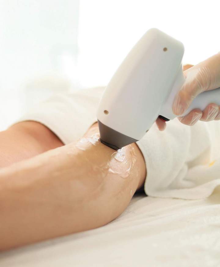 Épilation des jambes par laser Sherbrooke