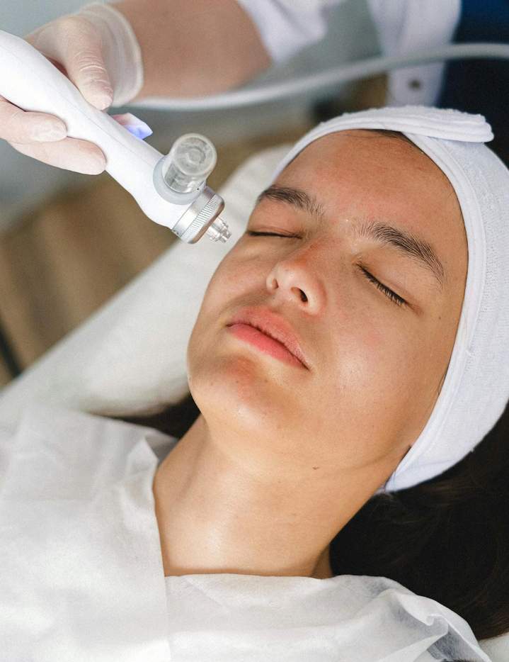 Épilation du visage par laser Sherbrooke